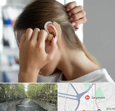 فروش اقساطی سمعک در زرگنده