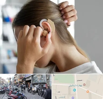 فروش اقساطی سمعک در چهارراه استانبول