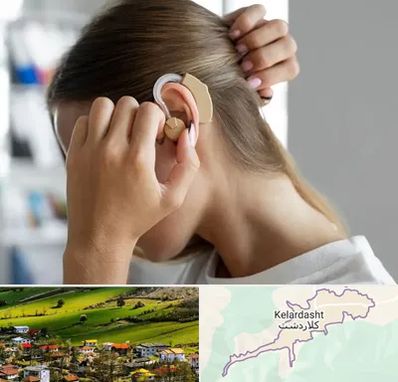 فروش اقساطی سمعک در کلاردشت