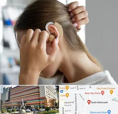 فروش اقساطی سمعک در سهروردی 