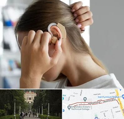 فروش اقساطی سمعک در بلوار معلم رشت 