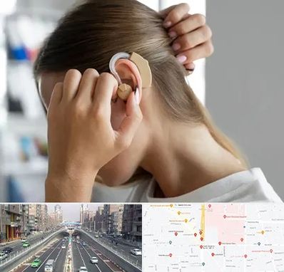 فروش اقساطی سمعک در توحید 