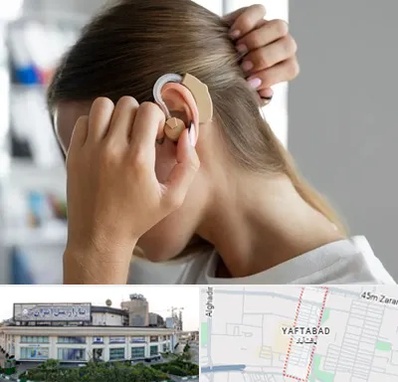 فروش اقساطی سمعک در یافت آباد