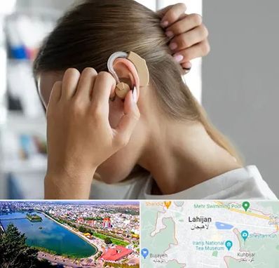 فروش اقساطی سمعک در لاهیجان