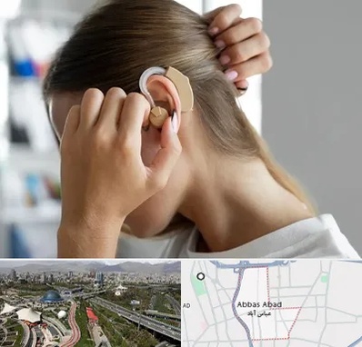فروش اقساطی سمعک در عباس آباد تهران
