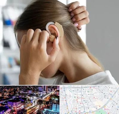 فروش اقساطی سمعک در منظریه رشت 