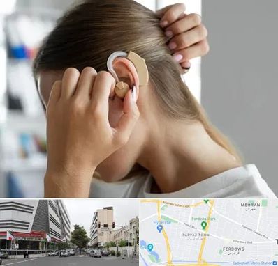 فروش اقساطی سمعک در بلوار فردوس 