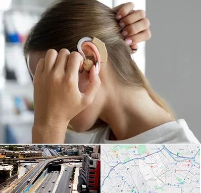 فروش اقساطی سمعک در ستارخان شیراز 