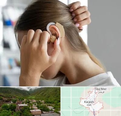 فروش اقساطی سمعک در کلاله