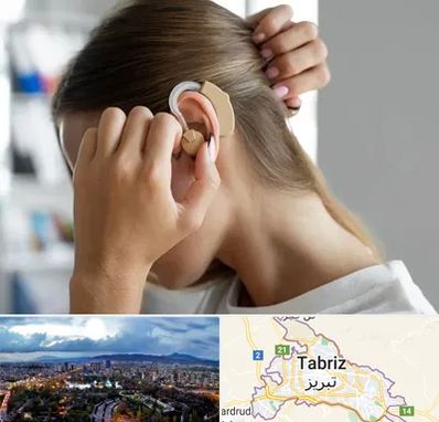 فروش اقساطی سمعک در تبریز