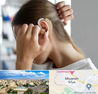 فروش اقساطی سمعک در میانه