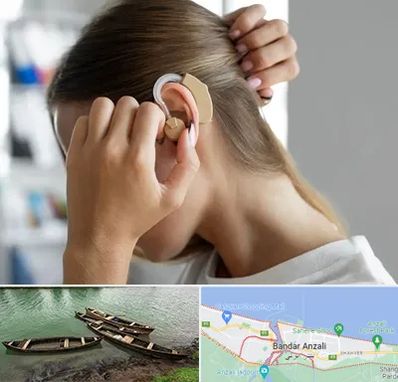 فروش اقساطی سمعک در بندر انزلی