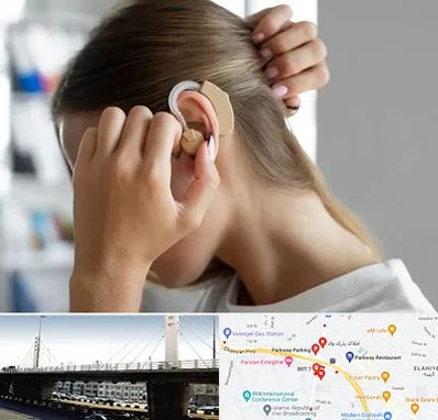 فروش اقساطی سمعک در پارک وی 