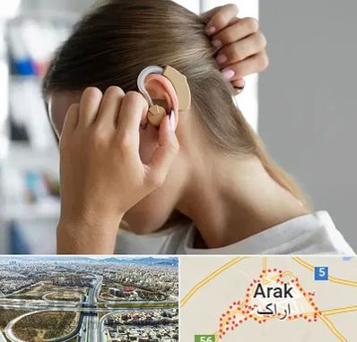 فروش اقساطی سمعک در اراک
