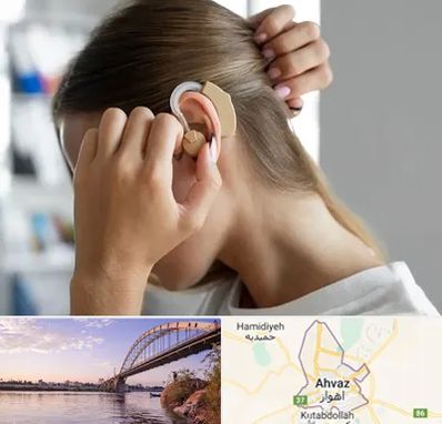 فروش اقساطی سمعک در اهواز