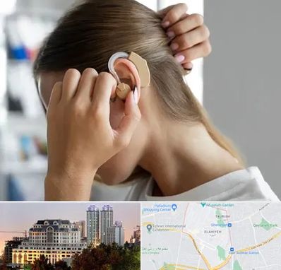 فروش اقساطی سمعک در فرشته 