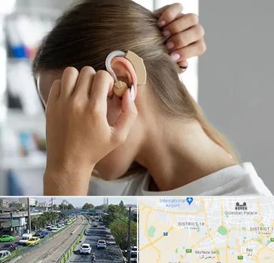 فروش اقساطی سمعک در جنوب تهران 