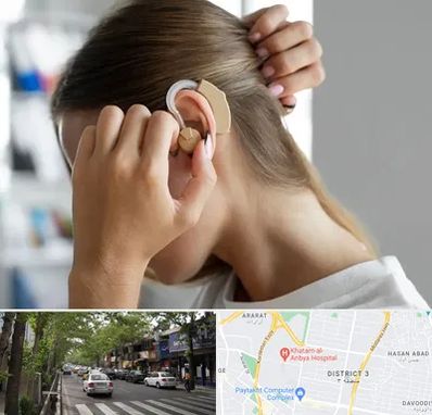 فروش اقساطی سمعک در ظفر 