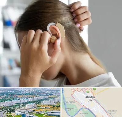 فروش اقساطی سمعک در آبادان