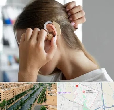 فروش اقساطی سمعک در فاز سه اندیشه