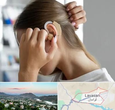 فروش اقساطی سمعک در لواسان