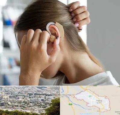 فروش اقساطی سمعک در یاسوج