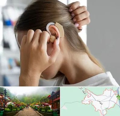 فروش اقساطی سمعک در فومن