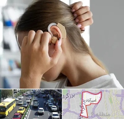 فروش اقساطی سمعک در امیرآباد