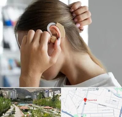 فروش اقساطی سمعک در بلوار تعاون