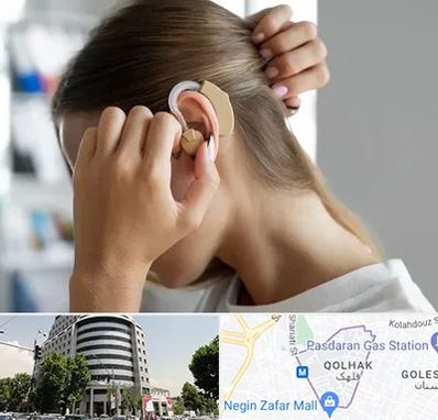 فروش اقساطی سمعک در قلهک 