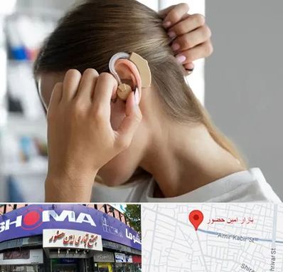 فروش اقساطی سمعک در امین حضور