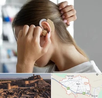 فروش اقساطی سمعک در بم