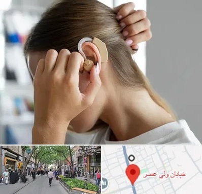 فروش اقساطی سمعک در ولیعصر شهریار