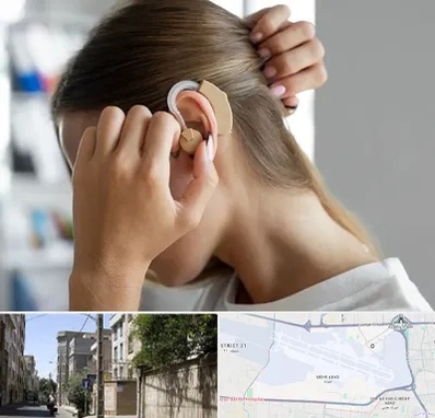 فروش اقساطی سمعک در مهرآباد