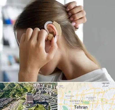 فروش اقساطی سمعک در شمال تهران 