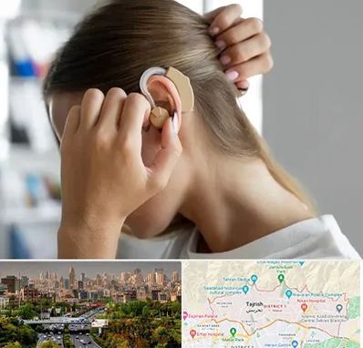 فروش اقساطی سمعک در منطقه 1 تهران 