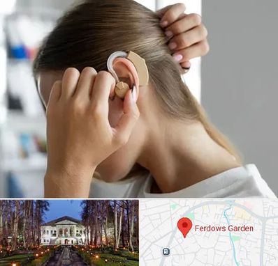 فروش اقساطی سمعک در باغ فردوس