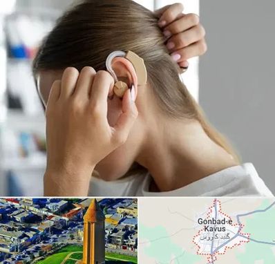 فروش اقساطی سمعک در گنبد کاووس