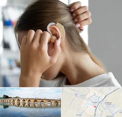 فروش اقساطی سمعک در فلاورجان