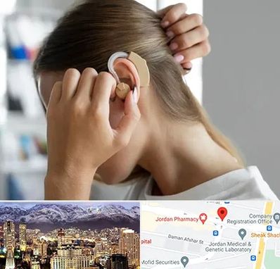 فروش اقساطی سمعک در جردن 