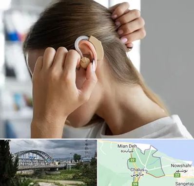 فروش اقساطی سمعک در چالوس