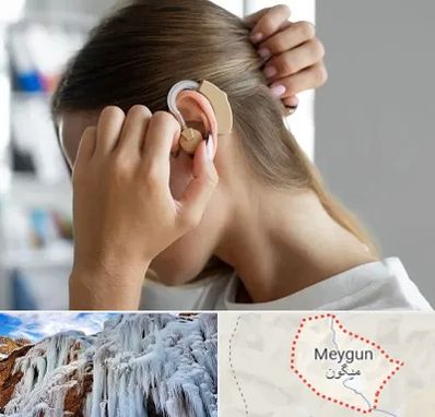 فروش اقساطی سمعک در میگون