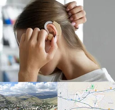 فروش اقساطی سمعک در رودهن