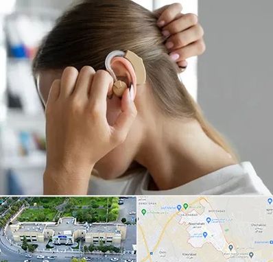 فروش اقساطی سمعک در نسیم شهر