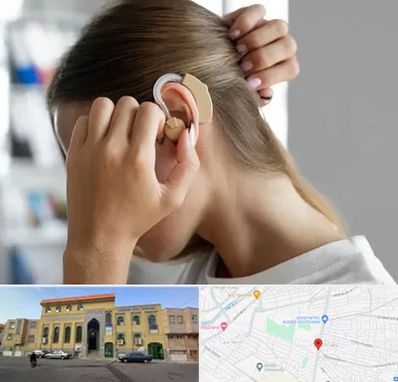 فروش اقساطی سمعک در زنبیل آباد قم