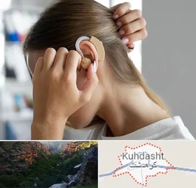 فروش اقساطی سمعک در کوهدشت