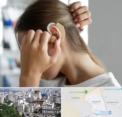 فروش اقساطی سمعک در ولنجک 