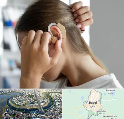 فروش اقساطی سمعک در بابل