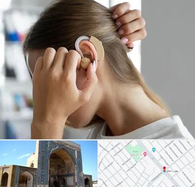 فروش اقساطی سمعک در مصلی مشهد