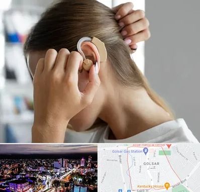 فروش اقساطی سمعک در گلسار رشت 